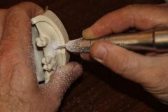 Maxillary Sinus Grafting_9