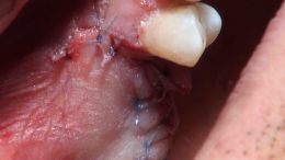 اصول مبانی GBR  - مدرس دکتر عمید