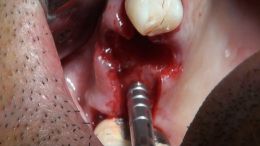 GBR - Course - 2019_4