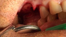 GBR - Course - 2019_6