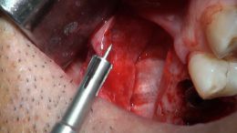 GBR - Course - 2019_9