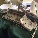 Immediate implementation and immediate loading_10