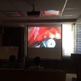 Immediate implementation and immediate loading_11