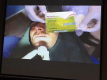 همايش دو روزه ايمپلنت و پيوند استخوان همراه با جراحي زنده  - همدان 95