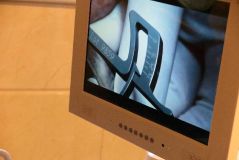 آموزش مراحل جراحي و پروتز ايمپلنت SPI سوييس همراه با جراحي زنده