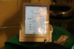 SPI system presentation with live surgery