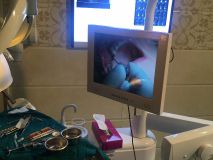 PeriAcryl tissue adhesive practical training with Live surgery