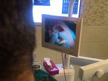 PeriAcryl tissue adhesive practical training with Live surgery